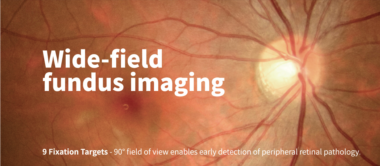 Automatic Fundus Camera FC162_20220428转曲-07.jpg